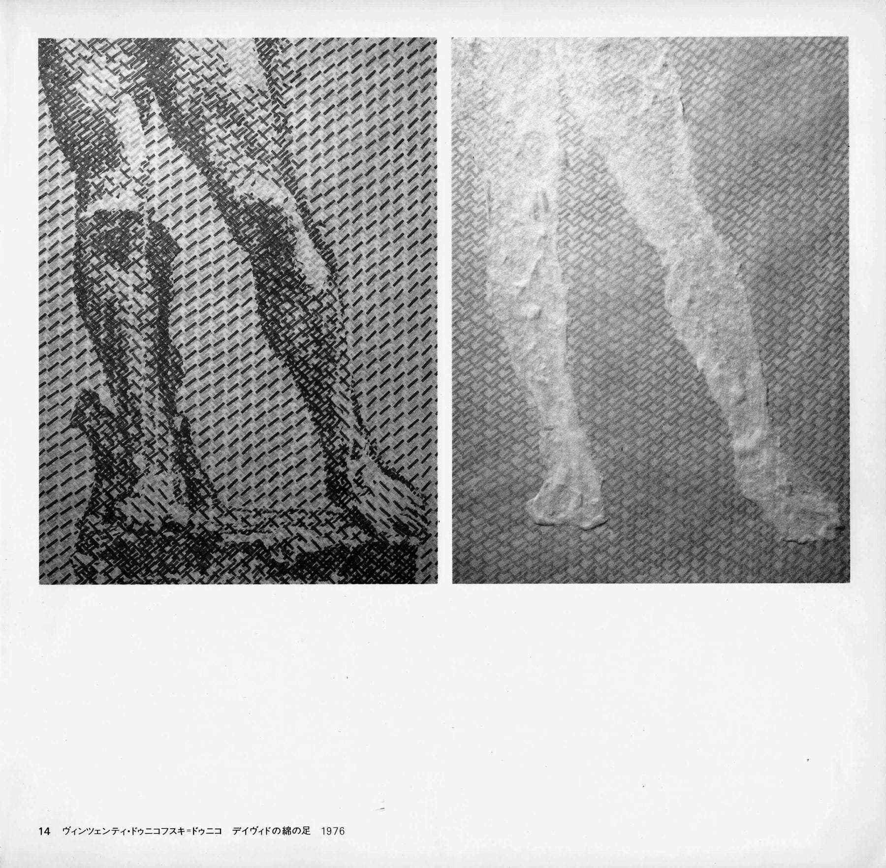 Wincenty Dunikowski-Dunikowski, David's Cotton Legs, 1980